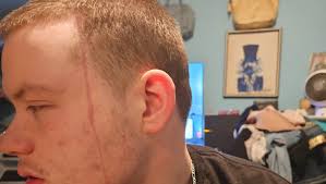 Fundraiser by Christee Fernandez : PLEASE HELP LOREN THRU THIS BRUTAL ATTACK