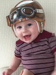 Kunstenaar transformeert medische helmen voor baby's in kunstwerken.