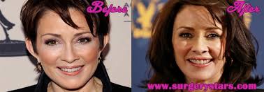 Therefore, she would like to go back all naturally to fit her body shape.you can see the change in her breast size clearly by the following picture:. Patricia Heaton Plastic Surgery Before And After Shoots