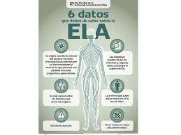 Los síntomas de esclerosis lateral amiotrófica. Esclerosis Lateral Amiotrofica 6 Datos Que Debes Conocer De La Enfermedad Esclerosis Lateral Esclerosis Lateral Amiotrofica Esclerosis