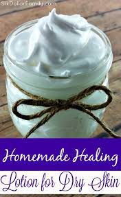 Homemade Healing Lotion For Dry Skin Homemade Healing Healing Lotion Lotion For Dry Skin