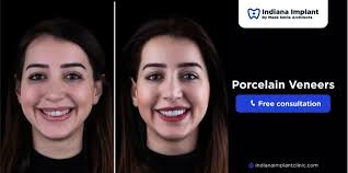 The Benefits of Choosing Permanent Porcelain Veneers