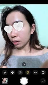 Case da sau ~3 tháng điều trị) Trộm vía khách hợp tác rất tốt: