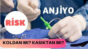 Anjiyo Nereden Yapilir Koldan Anjiyo Kasiktan Anjiyo Anjiyo Riskleri Doktorlar Videolar Varis