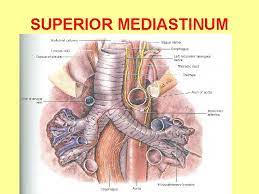 Middle), from latin mediastīnus (a common servant). Dr Ahmed Fathalla Ibrahim Definition Of Mediastinum It