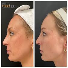 The Med Spa of New...