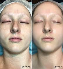 Ask an Esthetician: International Spa Aesthetic Department Leader, Edu