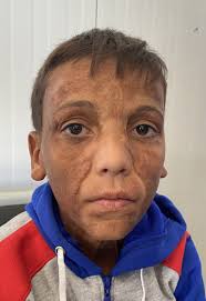 Interplast Kurdistan 2020