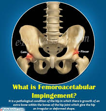 Pin On Joint Pain