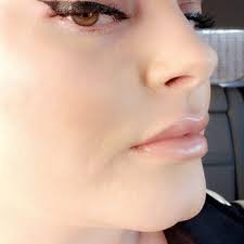 NEW HORIZON CENTER FOR COSMETIC SURGERY