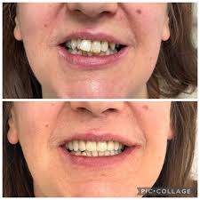 Ridare il sorriso ai miei pazienti migliorando la loro qualità di vita e…