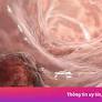 The Crucial Role of Early Cancer Detection and Regular Screening