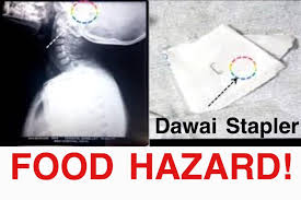 Contextual translation of stapler bullet into english. Seorang Kanak Kanak Perempuan Public Health Malaysia Facebook