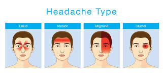 Image result for Acute Localized Headache