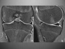 In a review of 79 patients with this disease, performed to establish guidelines f … Epos Trade