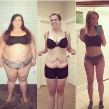 Pin On Before N After Weight Loss Pic