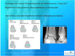 We would like to show you a description here but the site won't allow us. Grundlagen Der Nativen Rontgendiagnostik Des Christian Fiebig Pdf Kostenfreier Download