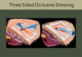 Image result for Occlusive Dressing