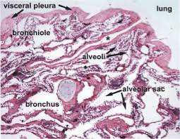 Bronchi are plural for bronchus and represent the passageways leading into the lungs. Low Magnification Image Of Lung Tissues A Visceral Pleura Forms The Download Scientific Diagram