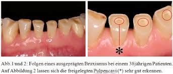 Die Zahne Das Spiegelbild Der Psyche Fachportal Fur Wehrmedizin Wehrpharmazie