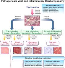 Myocarditis is when the walls of the heart become inflammed or swollen. Diagnosis And Treatment Of Myocarditis In Children In The Current Era Circulation