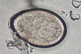 Maybe you would like to learn more about one of these? Escabiosis Pediculosis Y Picaduras De Artropodos Sciencedirect