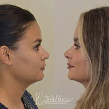 Dra. Nallely Chávez Delgado