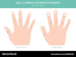 Image result for Digital Clubbing