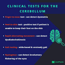 Image result for Cerebellar Function Test