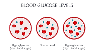 Childhood (male) type 1 diabetes (t1d) increases the risk for cd and vice versa and the early signs of celiac disease may precede t1d in many cases. Glucose Intolerance Signs Symptoms Treatment And Diet