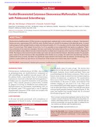 sclerotherapy of craniofacial venous malformations