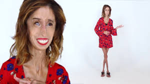 In january 2014 she gave a tedxaustinwomen talk titled how do you define yourself and her youtube videos have received over 54 million views. Lizzie Velasquez Ugliest Woman In The World Talks True Beauty