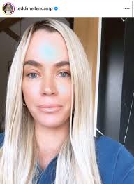 Teddi from Bravo Diagnosed with Stage 2 Cancer