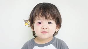 Tapi jika anda mendapati cairan yang keluar secara berlebih, warnanya pun. Penyebab Dan Gejala Sakit Mata Pada Anak Yang Wajib Diwaspadai Orami