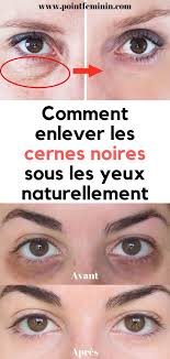 Pin On Remedes Naturels Fait Maison