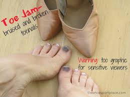 Make sure the entire surface and surrounding skin get treated and rub it in well. Toe Jam Dealing With Bruised And Broken Toenails Dancesport Place