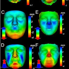 Craniofacial and neural crest defects in bbs zebrafish morphants. (A-E)... 