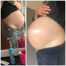 Ab wann der bauch wächst eine schwangerschaft zu verkennen, das kommt immer wieder mal vor. Bauch Abgesenkt Forum Fur Mai 2020 Mamis