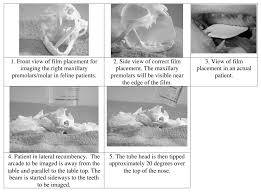 Simplified Positioning For Dental Radiology Dentalaire