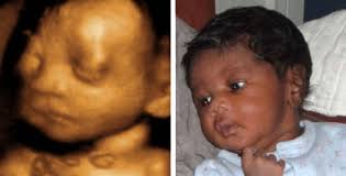 I started this business with a love of ultrasound, and with love of babies. 3d Ultrasound 4d Ultrasound Philadelphia Pa New Jersey