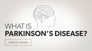 Tremors are common, but the disorder also commonly causes stiffness or slowing of movement. What Is Parkinson S Disease Youtube