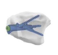 Distal Tibial Fracture,DTN Distal Tibial Nail ,Medical ...