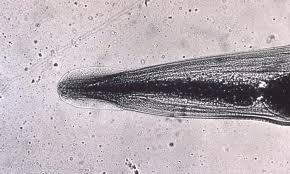 Image result for Pinworm