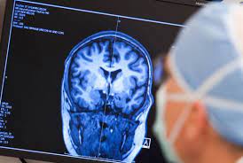 Setiap penyakit yang diderita di mata akan sulit untuk disembuhkan. Saat Allah Swt Siapkan Ganjaran Untuk Penyandang Epilepsi Republika Online