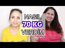 Nasil 70 Kilo Verdim Part 2 Nasil Zayifladim Vucudum Sarkti Mi Nerede Ameliyat Oldum Busra Ipek Youtube