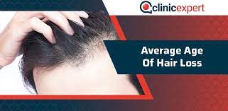 Would you have hair loss when taking cimetidine? Average Age Of Hair Loss Clinicexpert International Hair Transplant Plastic Surgery