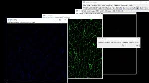 Muscle Morphometry Plugin For Imagej Or Fiji Youtube