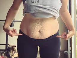 17 Women Share Pics Of Loose Skin After Weight Loss To Prove How Common And  Normal It Is | Self