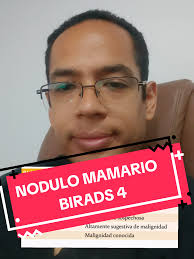 Guía sobre Nódulo Mamario y BIRADS 4