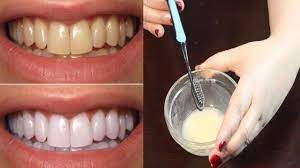 Dentist mandy kouroshnia of new york's unison family dental says for the best results with whitening products at home. How To Whiten Teeth Best Teeth Whitening Method Teeth Whitening At Home Youtube